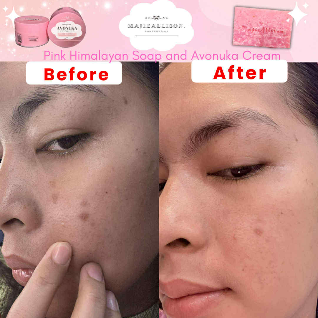 AVONUKA Emollient Cream jar opened to show texture